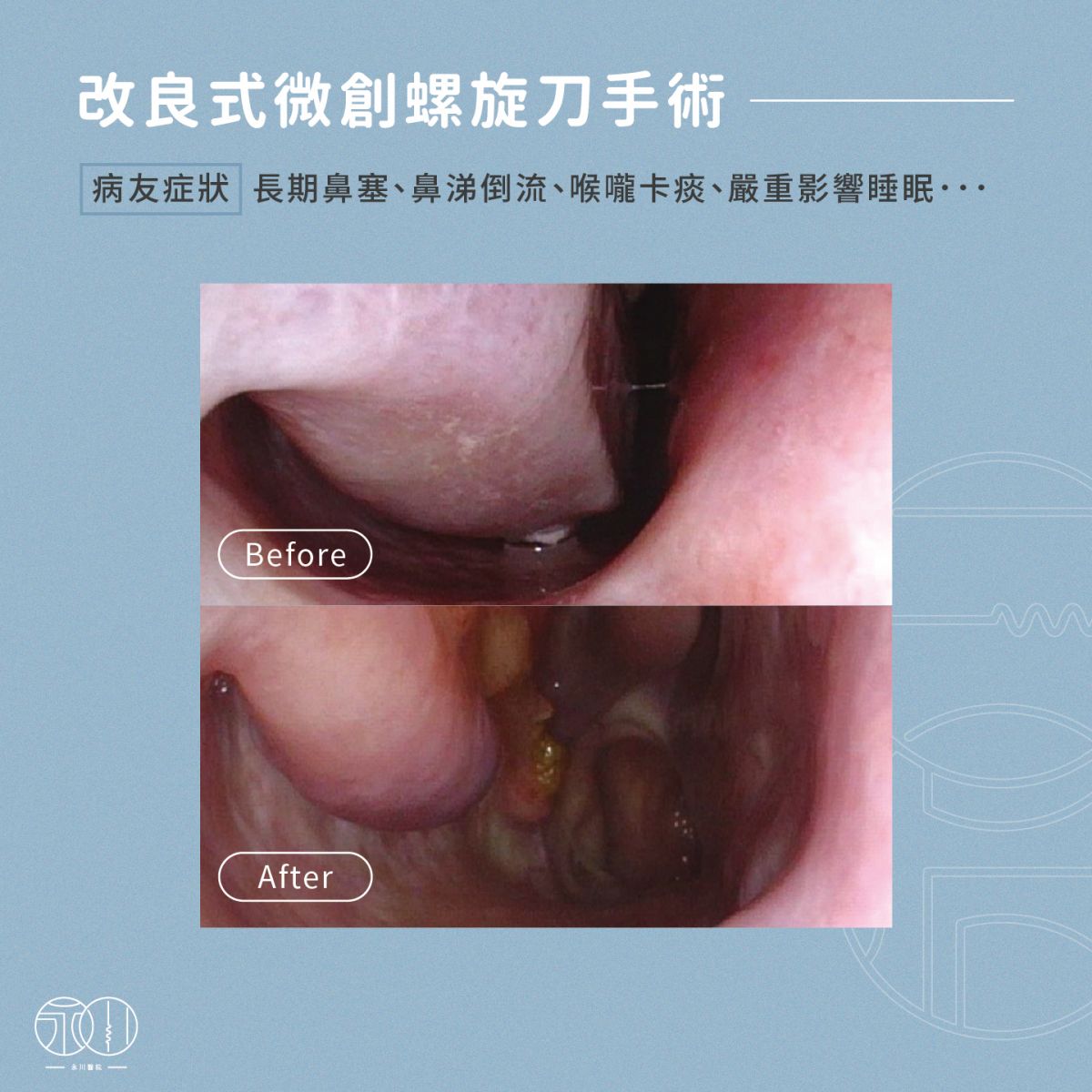 病友症狀說明