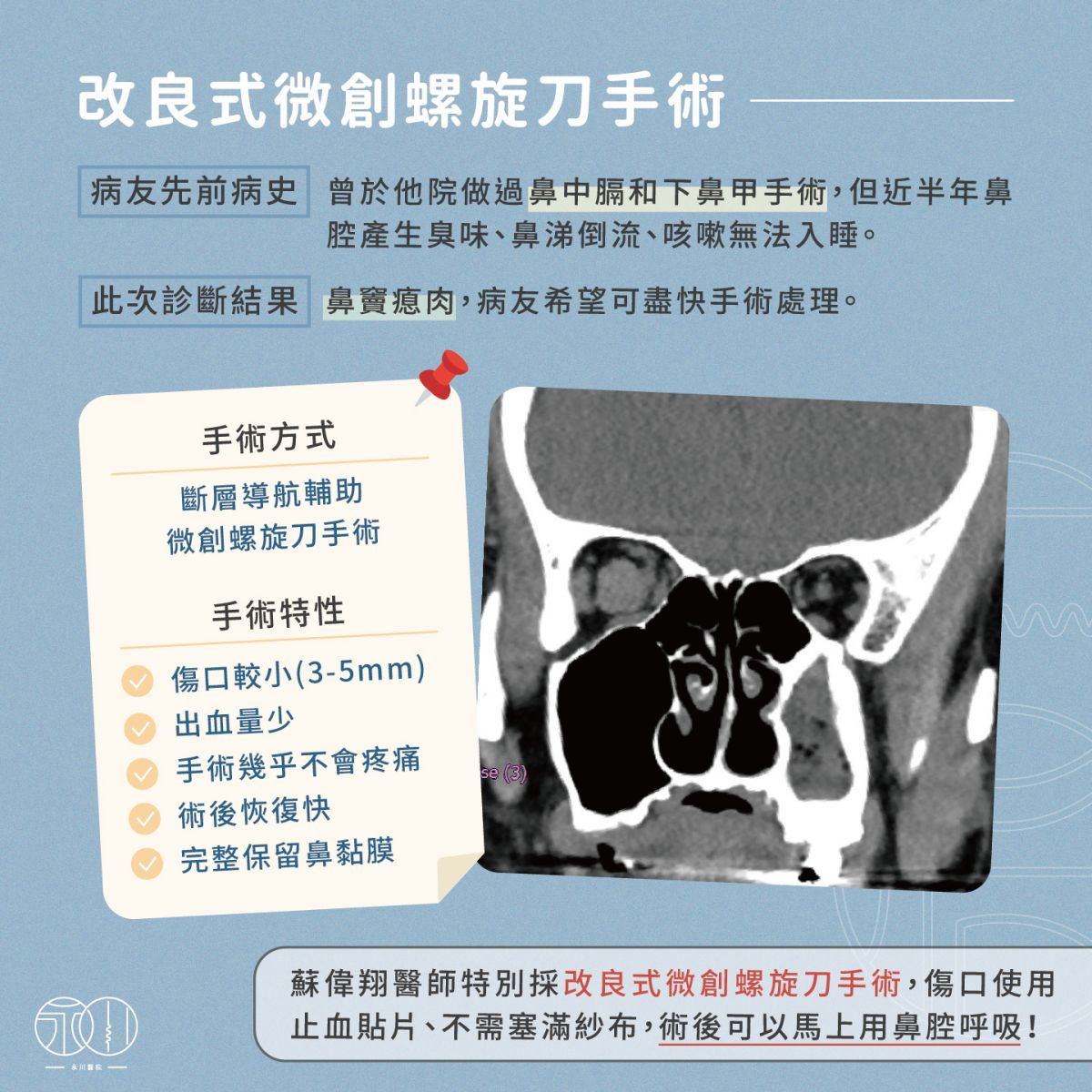 鼻竇息肉病友診斷結果