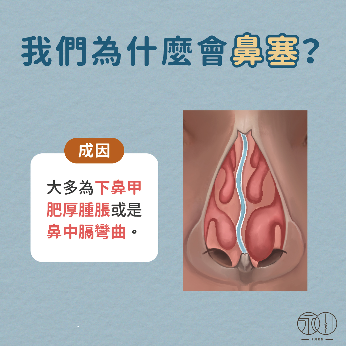 為什麼會鼻塞