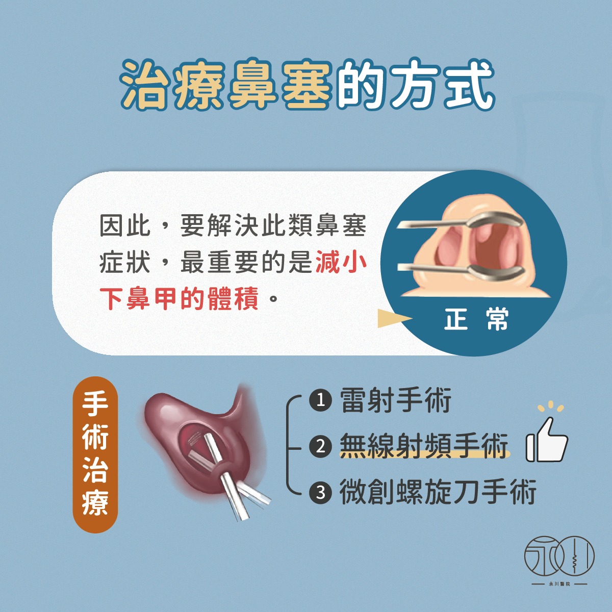 治療鼻塞的方式