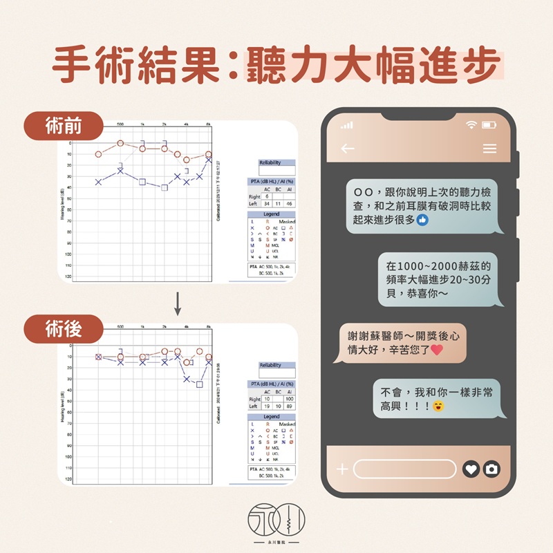 【案例】慢性中耳炎耳鳴破損