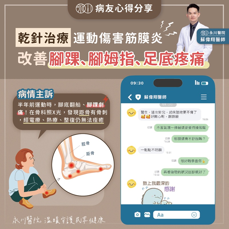 【案例】乾針治療X腳底翻船
