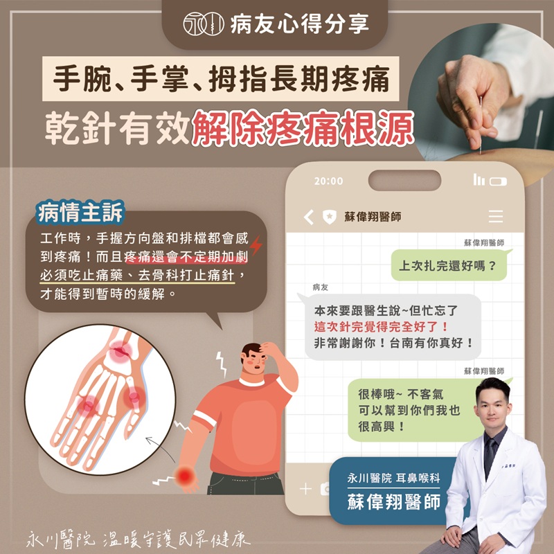 【案例】乾針治療X右手腕和拇指疼痛